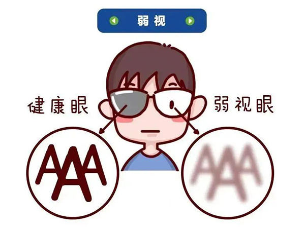 品牌學科 | 孩子弱視需早治 把握治療黃金期