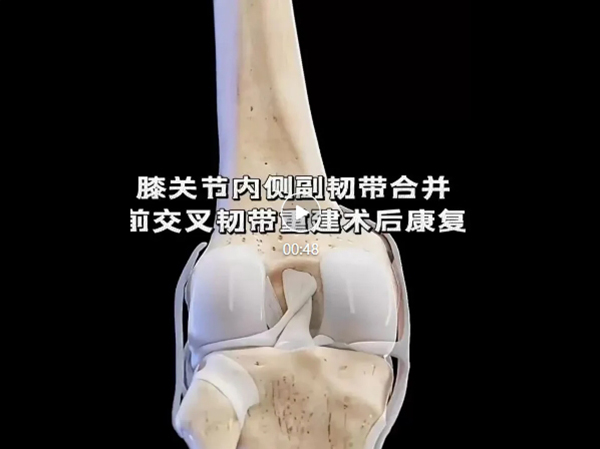 優(yōu)勢技術 | 前交叉韌帶重建 手術不是終點術后康復加快重獲運動能力