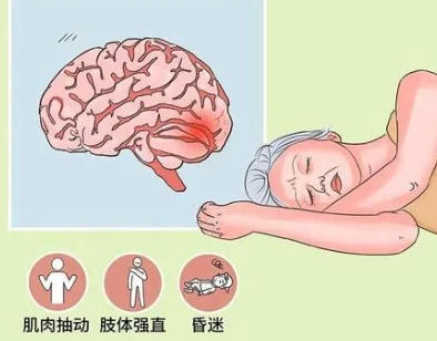 優(yōu)勢學(xué)科|17 年癲癇折磨終解脫！錦州市中心醫(yī)院癲癇門診規(guī)范治療為患者點(diǎn)亮希望之光